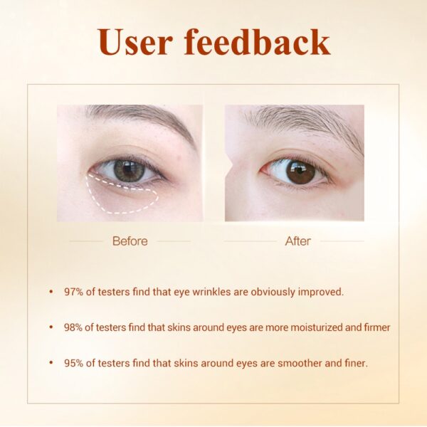 Collagen Eye Patch Hyaluronic Acid Moisturizing Retinol Anti Aging Remove Dark Circles 3