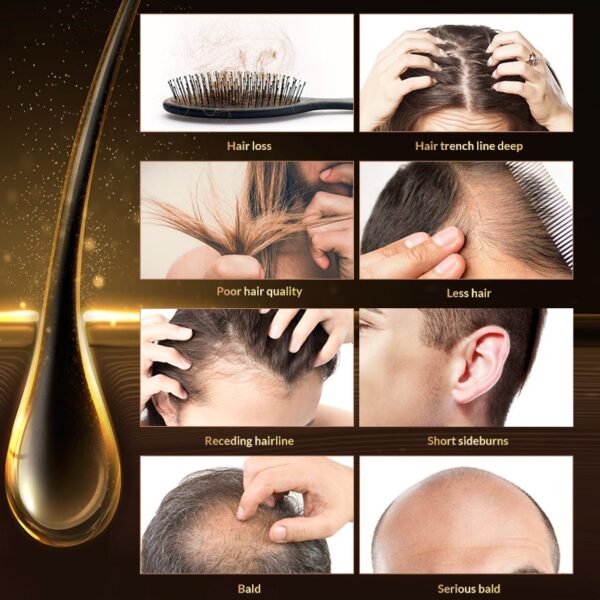 Anti Hair Loss Hair Growth Spray Essential Liquid Oil  4