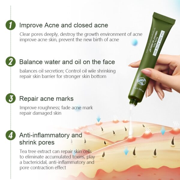 Tea Tree Acne Gel Moisturizing Remove Acne Shrink Pores Anti-inflammatory 2