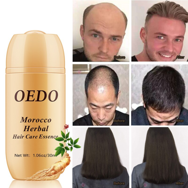 Morocco Herbal Hair Care Essence 2