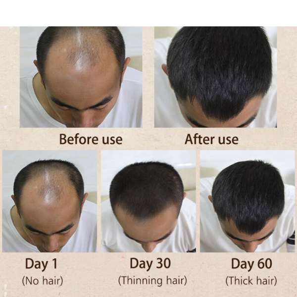 Morocco Herbal Hair Care Essence 3