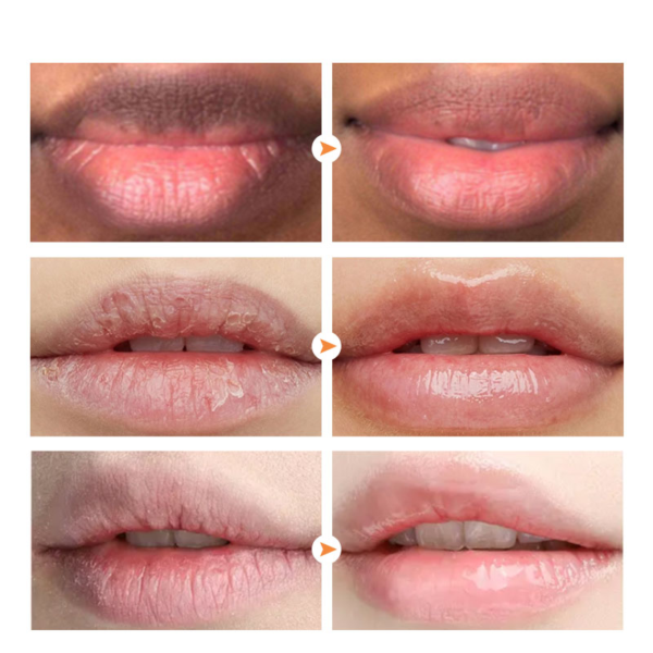 Bubble Lip Lightening Mask For Dark Lips Moisturizing Remove Dead Skin Reduce Pigmentation 3